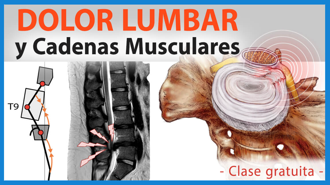 Lumbago y Cadenas Musculares Lumbago y Cadenas Musculares