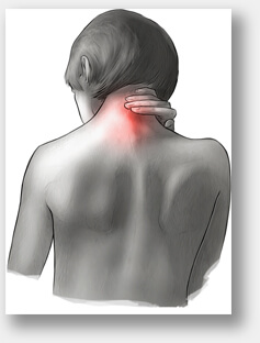 dolor de cuello