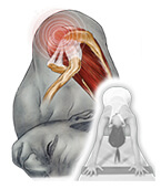 yoga terapeutico extremidad superior