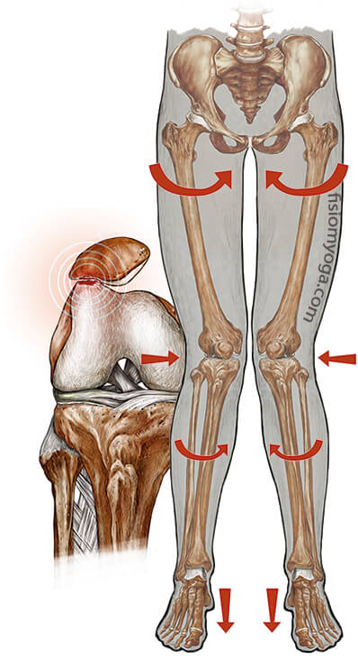 artrosis rodilla