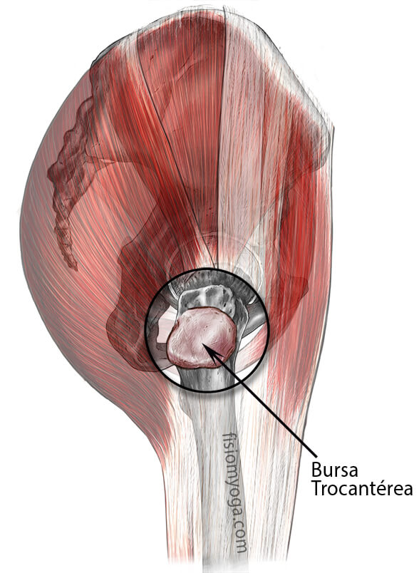 Visión lateral de la cadera Bursitis trocánter
