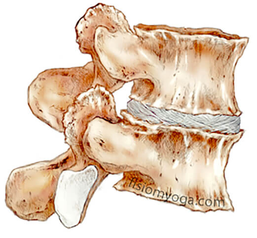 artrosis-columna columna