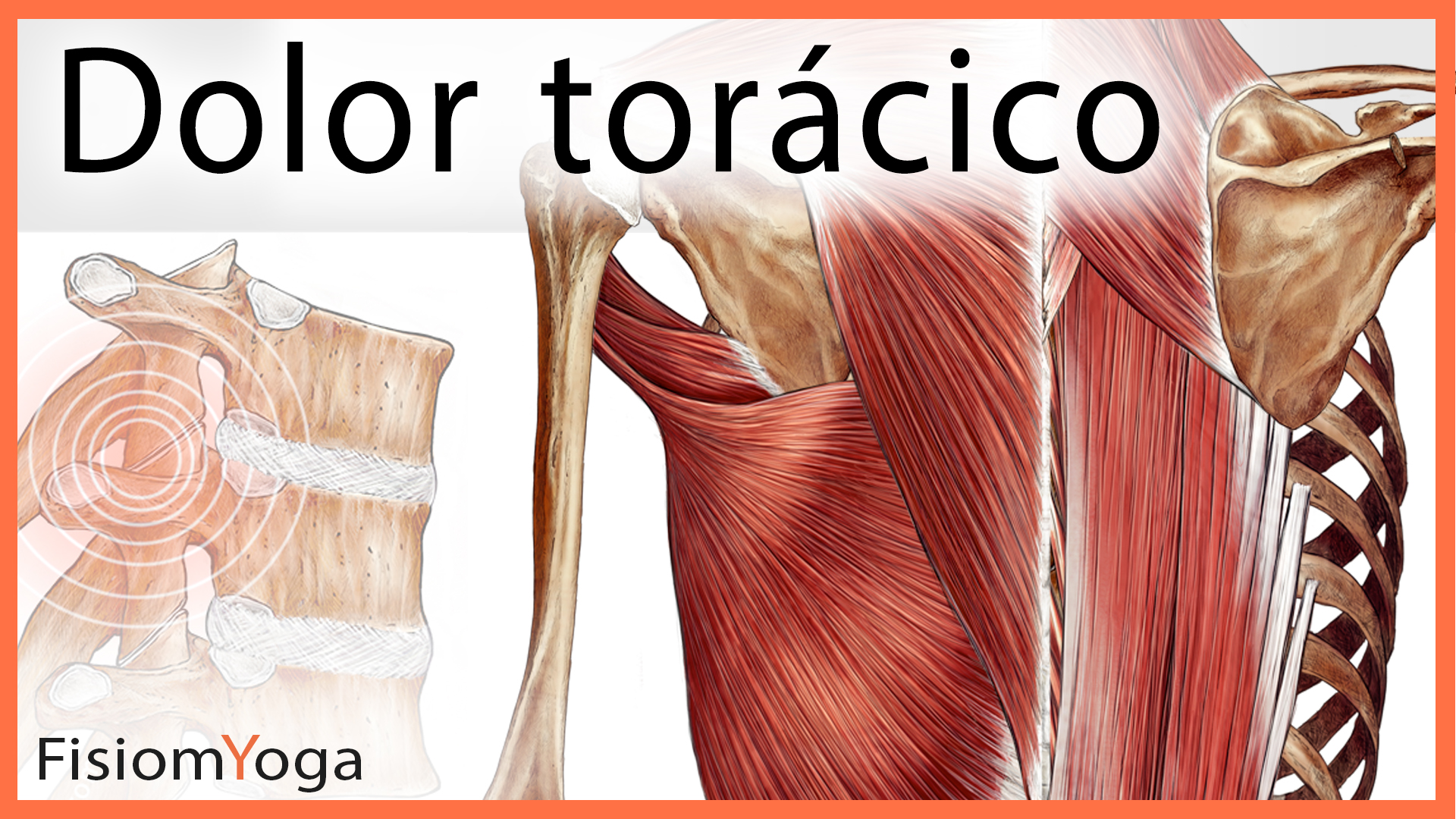 Dolor de Espalda Dolor de Espalda