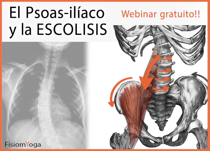tratamiento-ejercicios-escoliosis