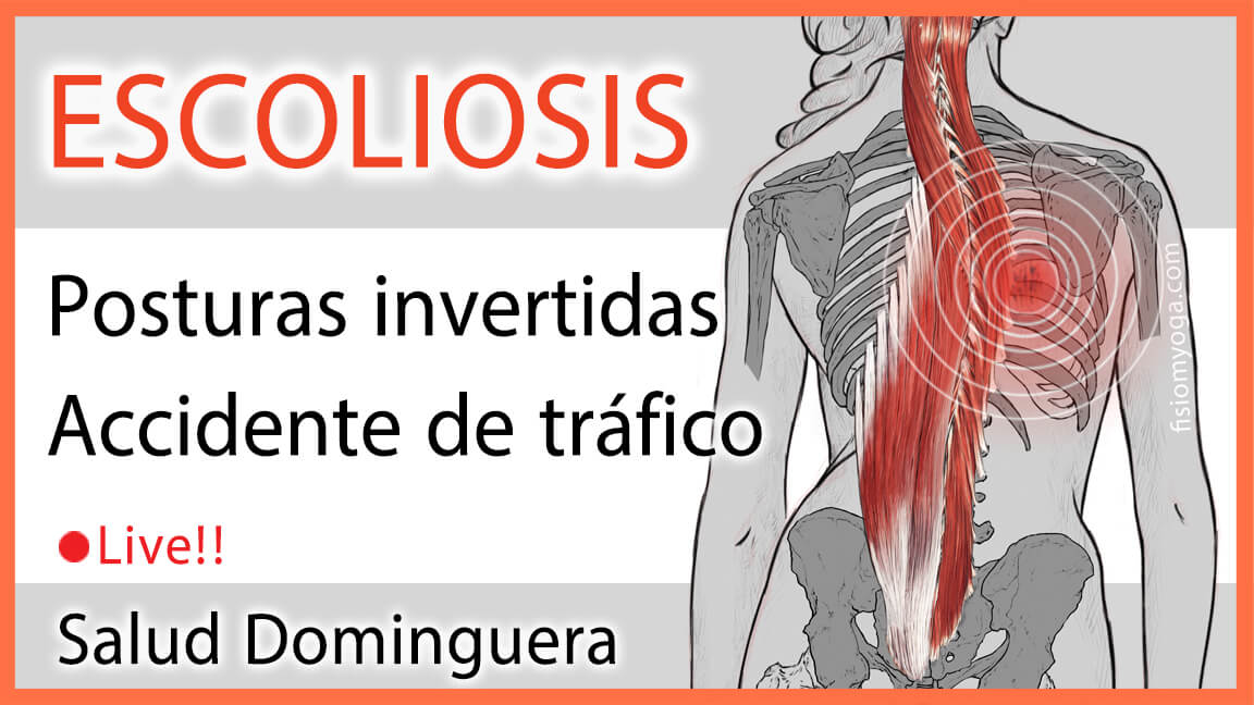 Escoliosis: Posturas Invertidas y Accidente de tráfico Escoliosis: Posturas Invertidas y Accidente de tráfico