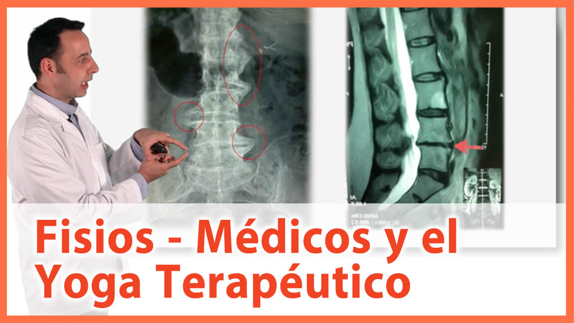 Papel de los Fisioterapeutas en el Yoga Terapéutico Papel de los Fisioterapeutas en el Yoga Terapéutico