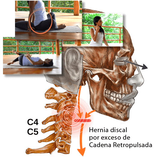 clases cadenas musculares y emociones
