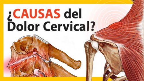 02-causas-de-la-cervicalgia-petit causas del la cervicalgia