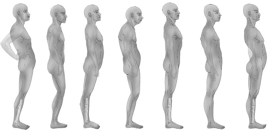 cervicalgia postural