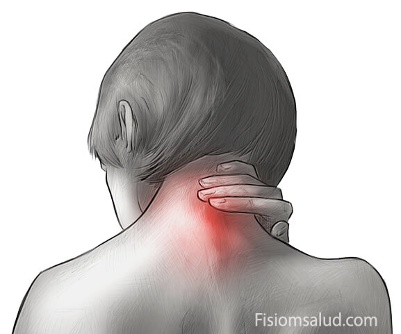 dolor de cuello