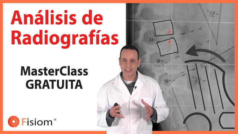 VIVO: MasterClass de Análisis de Radiografías VIVO: MasterClass de Análisis de Radiografías