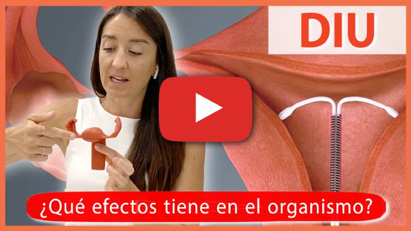 DIU, sabes cómo afecta tu suelo pélvico? DIU, sabes cómo afecta tu suelo pélvico?