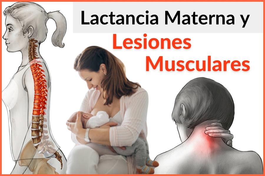 Lactancia Materna y Lesiones Musculares Lactancia Materna y Lesiones Musculares