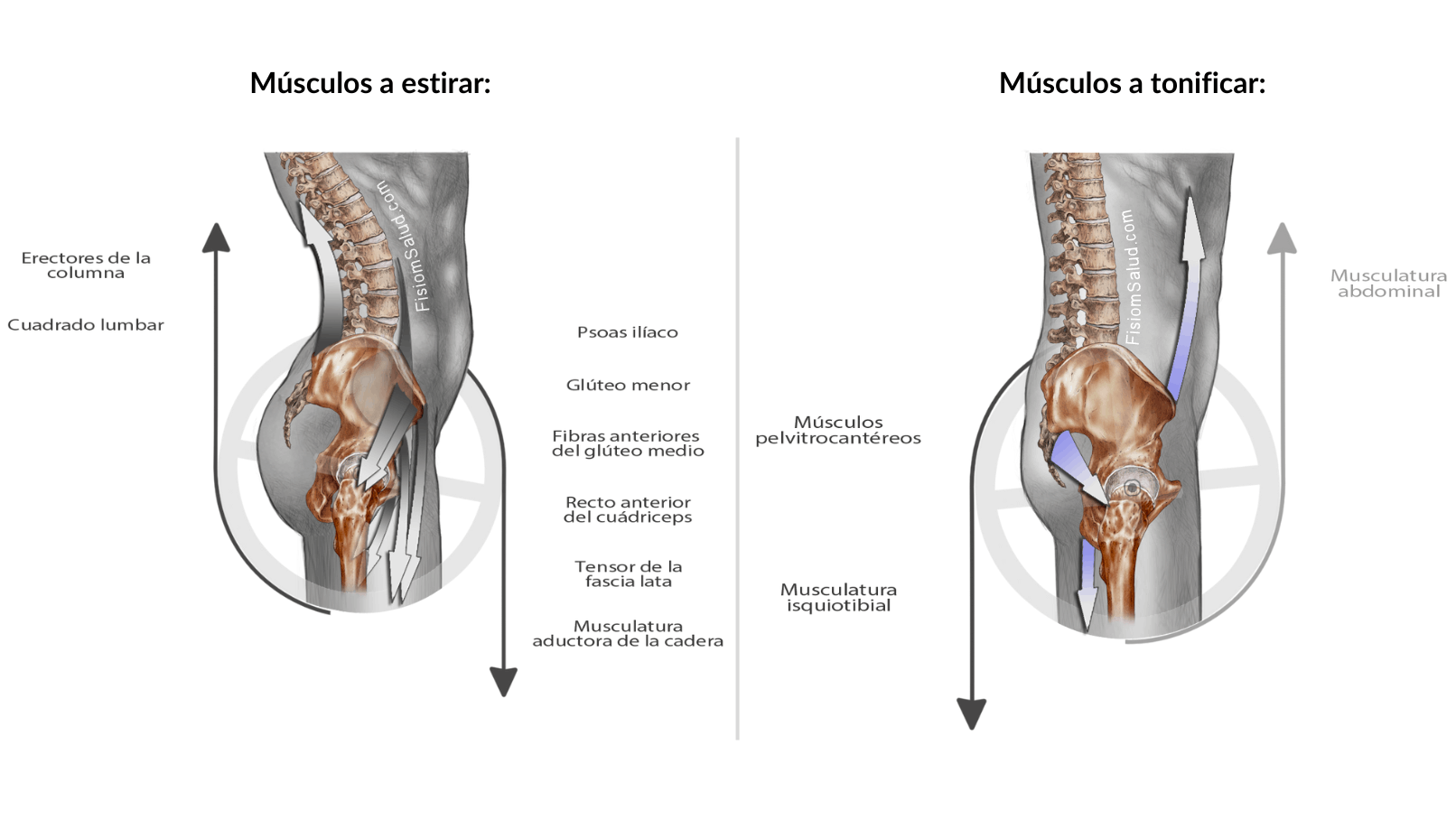Musculatura a tonificar y estirar en casos de hiperlordosis
