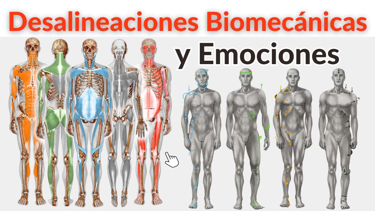Desalineaciones Biomecánicas Desalineaciones Biomecánicas