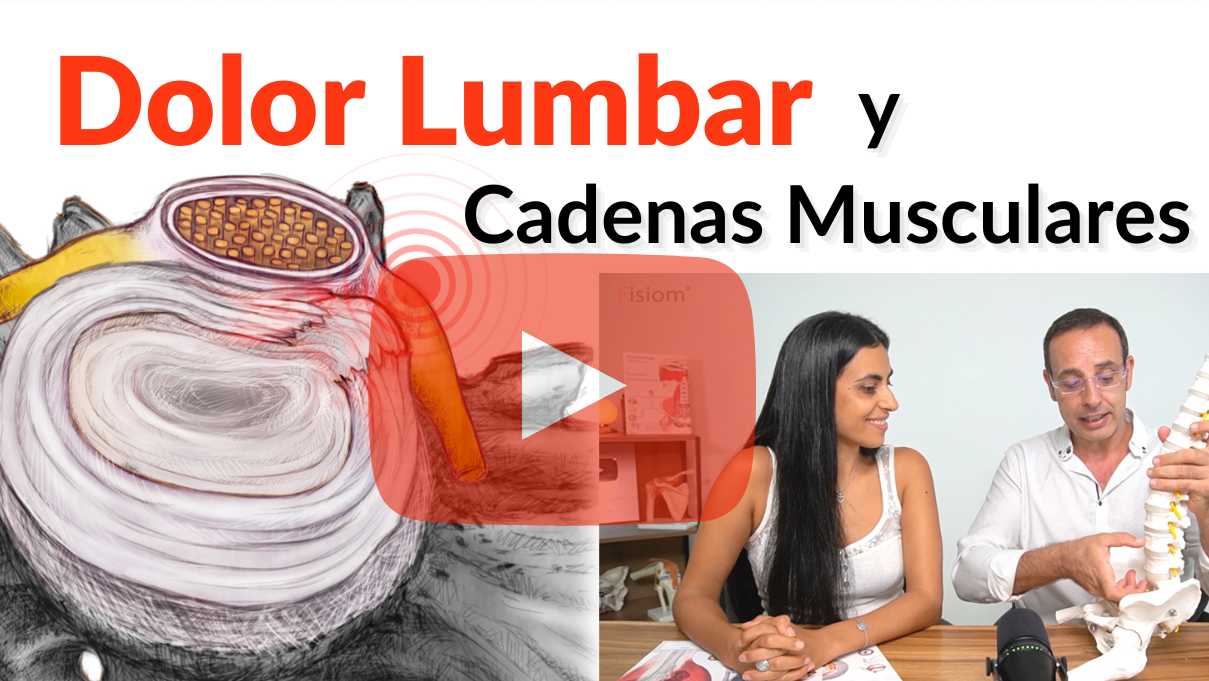 DOLOR Lumbar y Cadenas Musculares DOLOR Lumbar y Cadenas Musculares
