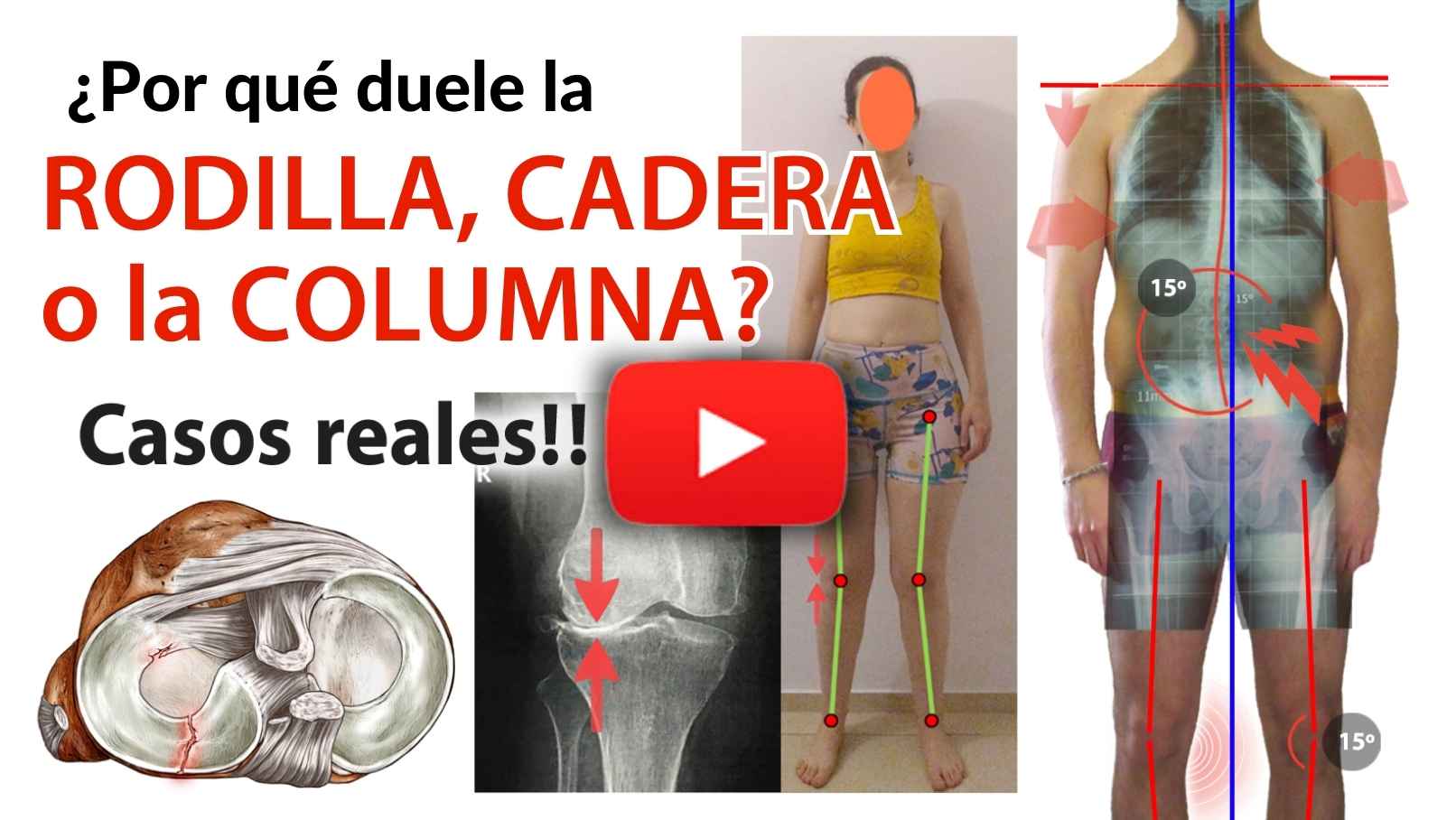 ¿Por qué duelen las articulaciones? ¿Por qué duelen las articulaciones?