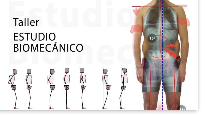 Checklist Rápido de Evaluación Postural